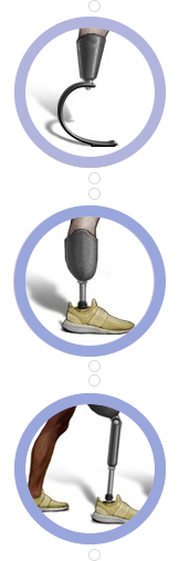 prosthetics and orthotics types