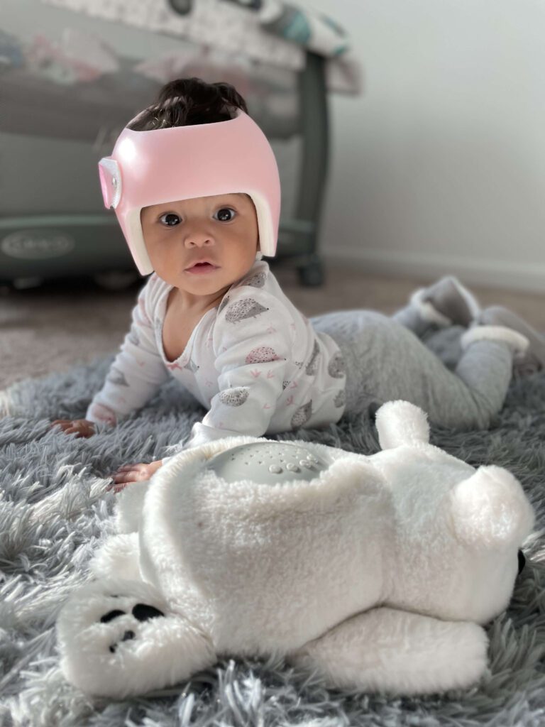 cranial helmet for babies