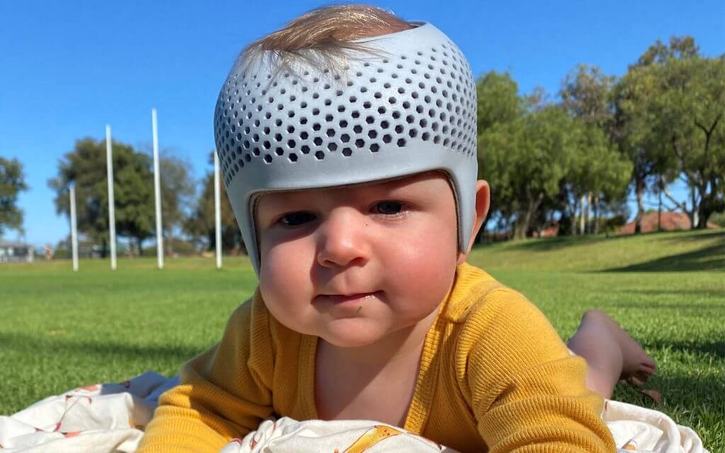 Cranial Helmets for Babies